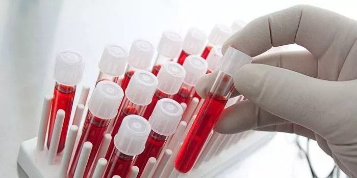 Hematológ - kto to je, oblasť činnosti špecialistu, s akými vyšetreniami musíte ísť na stretnutie