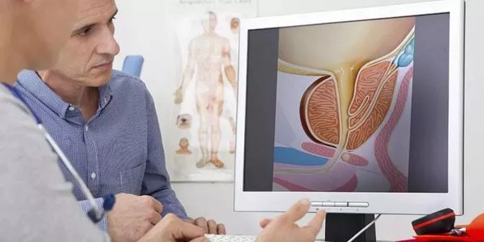 HPV typ 16 u mužov - príznaky, testy na zistenie, nebezpečné následky, terapia a prevencia