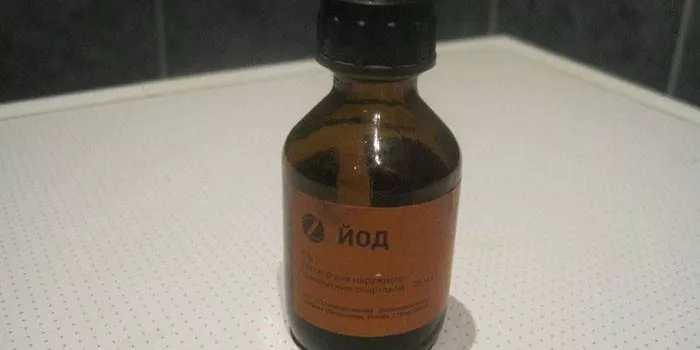 Liječenje gljivica noktiju jodom na nogama i rukama: pomaže li narodni lijek kod onihomikoze
