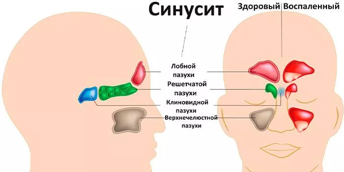 Příčiny bolesti při dýchání v chladu